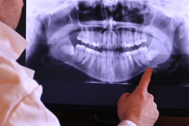 Best Emergency Root Canal Treatment in Macon, MO