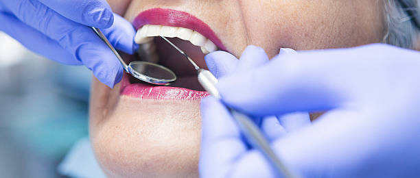 Best Emergency Treatment for Toothache in Macon, MO